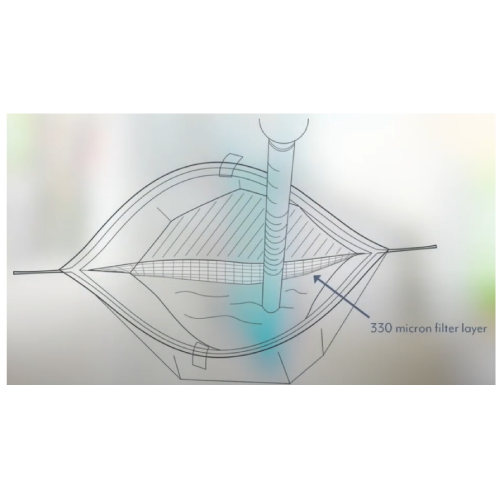필터 멸균백 B01525 필터로 걸러 깨끗한 샘플채취 NASCO 38 x 38cm